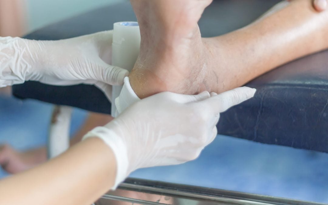 Reimbursement Optimization for Wound Care Services: A Guide for Hospitals